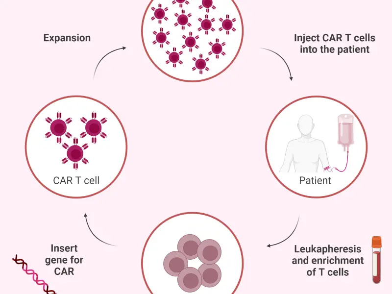 Overview of CAR T-cell therapy in the management of systemic lupus erythematosus