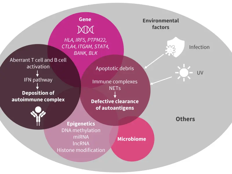 Clinical considerations in the diagnosis and management of systemic lupus erythematosus 
