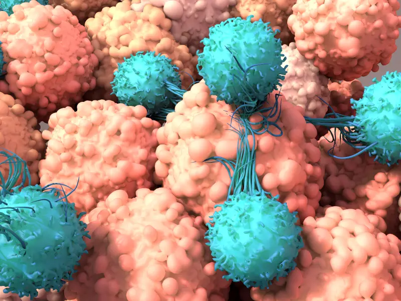 Efficacy and safety of anti-CD19 CAR T-cell therapy in patients with refractory systemic lupus erythematosus
