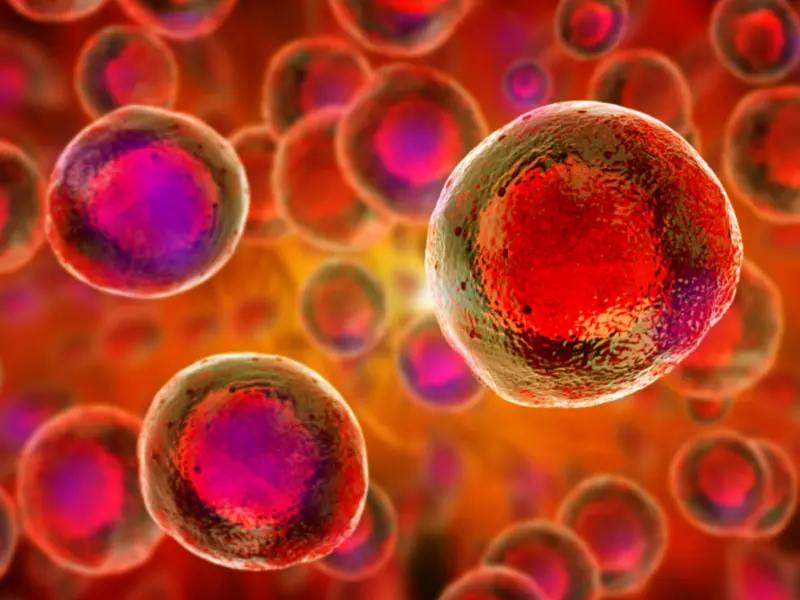 RIC allo-SCT vs HMA or best supportive care in older patients with high-risk MDS